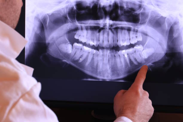 Professional Emergency Dental Service in CT